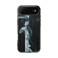Case